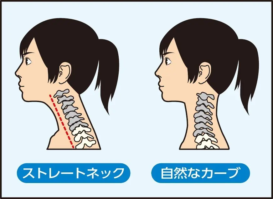 ストレートネックの説明